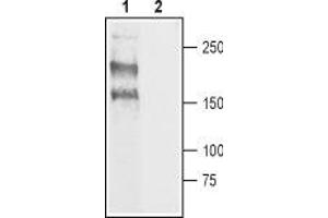 Western blot analysis of rat DRG lysate: - 1. (Nav1.8 antibody  (C-Term, Intracellular))