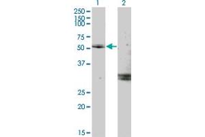 Western Blot analysis of MYOC expression in transfected 293T cell line by MYOC monoclonal antibody (M02), clone 2B4.