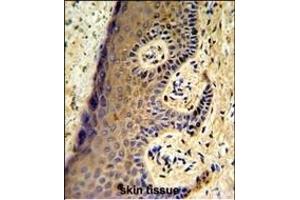 Forlin-fixed and paraffin-embedded hun skin reacted with FF Antibody (Center), which was peroxidase-conjugated to the secondary antibody, followed by DAB staining. (MafF antibody  (AA 66-92))