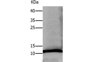 Western Blot analysis of Human lung tissue using DEFA1 Polyclonal Antibody at dilution of 1:550 (alpha Defensin 1 antibody)