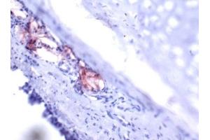 Immunohistochemistry (IHC) image for anti-Trefoil Factor 1 (TFF1) (AA 57-84), (C-Term) antibody (ABIN781662) (TFF1 antibody  (C-Term))