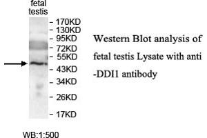 Image no. 1 for anti-DNA-Damage Inducible 1 Homolog 1 (DDI1) antibody (ABIN1576032) (DDI1 antibody)