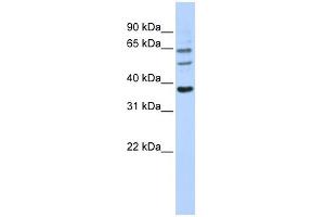 UGT1A9 antibody used at 1 ug/ml to detect target protein.
