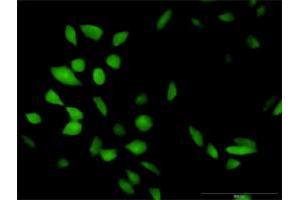 Immunofluorescence of purified MaxPab antibody to CISH on HeLa cell.
