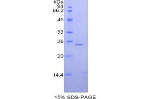 SDS-PAGE analysis of Mouse alpha Fodrin Protein.