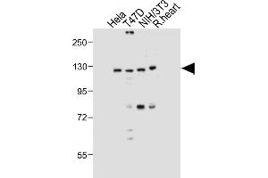 All lanes : Anti-Dnmt3a Antibody at 1:1000 dilution Lane 1: Hela whole cell lysate Lane 2: T47D whole cell lysate Lane 3: NIH/3T3 whole cell lysate Lane 4: Rat heart tissue lysate Lysates/proteins at 20 μg per lane. (DNMT3A antibody  (AA 457-486))