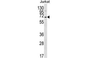 Western blot analysis of PSAPL1 Antibody (N-term) in Jurkat cell line lysates (35ug/lane). (PSAPL1 antibody  (N-Term))