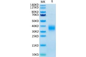 Mouse LAIR1 on Tris-Bis PAGE under reduced conditions.