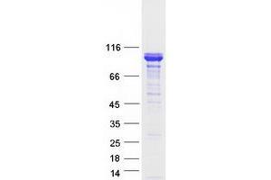 Western Blotting (WB) image for Breast Carcinoma Amplified Sequence 1 (BCAS1) protein (Myc-DYKDDDDK Tag) (ABIN2715177)