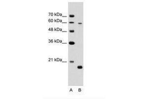Image no. 2 for anti-Solute Carrier Family 38 Member 4 (SLC38A4) (AA 381-430) antibody (ABIN203468) (SLC38A4 antibody  (AA 381-430))