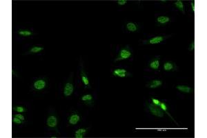 Immunofluorescence of purified MaxPab antibody to RFX2 on HeLa cell. (RFX2 antibody  (AA 1-723))