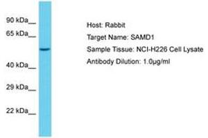 SAMD1 antibody  (AA 434-483)