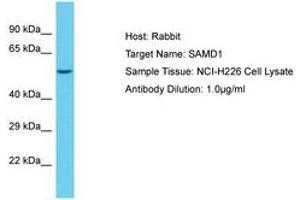 Image no. 1 for anti-Sterile alpha Motif Domain Containing 1 (SAMD1) (AA 434-483) antibody (ABIN6750543) (SAMD1 antibody  (AA 434-483))