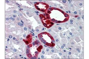 Human Kidney: Formalin-Fixed, Paraffin-Embedded (FFPE) (UCHL1 antibody  (C-Term))