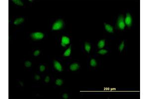 Immunofluorescence of purified MaxPab antibody to CRABP2 on HeLa cell. (CRABP2 antibody  (AA 1-138))