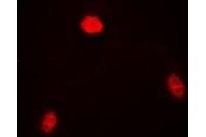 Immunofluorescent analysis of TARDBP staining in SW620 cells. (TARDBP antibody)