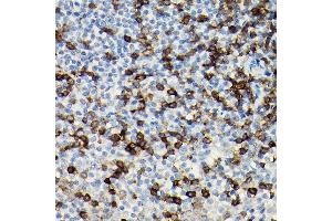 Immunohistochemistry of paraffin-embedded Human tonsil using CD3H antibody (ABIN3022812, ABIN3022813, ABIN3022814 and ABIN6219240) at dilution of 1:100 (40x lens). (CD247 antibody  (AA 50-164))