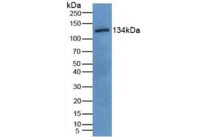 Detection of EGF in Porcine Uterus Tissue using Polyclonal Antibody to Epidermal Growth Factor (EGF) (EGF antibody  (AA 45-275))