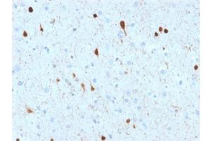 Formalin-fixed, paraffin-embedded human Cerebellum stained with Calretinin Mouse Monoclonal Antibody (CALB2/2602). (Calretinin antibody  (AA 23-242))