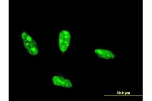 Immunofluorescence of monoclonal antibody to NHLH2 on HeLa cell. (NHLH2 antibody  (AA 36-135))
