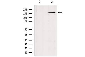 Western blot analysis of extracts from mouse brain, using Collagen XVII Antibody. (COL17A1 antibody  (N-Term))