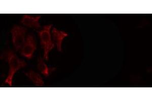 ABIN6266595 staining SKOV3 cells by IF/ICC. (MMP23B antibody  (C-Term))