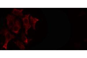 ABIN6266595 staining SKOV3 cells by IF/ICC. (MMP23B antibody  (C-Term))