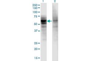 Western Blot analysis of DSTYK expression in transfected 293T cell line by DSTYK monoclonal antibody (M06), clone 1F9.