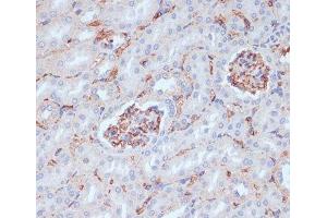 Immunohistochemistry of paraffin-embedded Mouse kidney using CD34 Polyclonal Antibody at dilution of 1:100 (40x lens). (CD34 antibody)