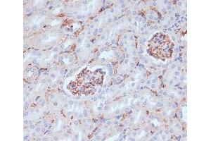 Immunohistochemistry of paraffin-embedded Mouse kidney using CD34 Polyclonal Antibody at dilution of 1:100 (40x lens). (CD34 antibody)