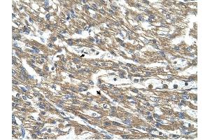 Cystathionase antibody was used for immunohistochemistry at a concentration of 4-8 ug/ml to stain Myocardial cells (arrows) in Human Head. (CTH antibody)