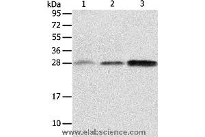 Western blot analysis of Human fetal liver and seminoma tissue, RAW264. (ALKBH2 antibody)