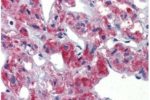 Human Adrenal (formalin-fixed, paraffin-embedded) stained with TAL1 antibody ABIN462261 followed by biotinylated goat anti-rabbit IgG secondary antibody ABIN481713, alkaline phosphatase-streptavidin and chromogen. (TAL1 antibody  (C-Term))