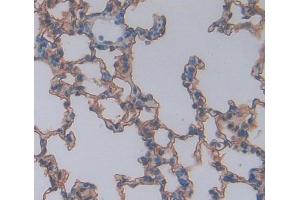 #VALUE! (BTLA antibody  (AA 30-183))