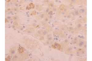 Detection of FGL1 in Human Liver Tissue using Polyclonal Antibody to Fibrinogen Like Protein 1 (FGL1) (FGL1 antibody  (AA 23-312))