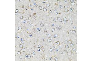 Immunohistochemistry of paraffin-embedded rat brain using BEST1 antibody (ABIN6003520) at dilution of 1/100 (40x lens). (Bestrophin 1 antibody)