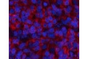 Immunofluorescence (IF) image for anti-Signal Transducer and Activator of Transcription 1, 91kDa (STAT1) (pTyr701) antibody (ABIN7250764)