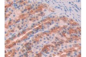 DAB staining on IHC-P; Samples: Rat Stomach Tissue (GAS6 antibody  (AA 356-511))