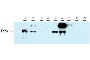 Tet3 antibody (pAb) tested by Western blot. (TET3 antibody  (AA 1159-1329))