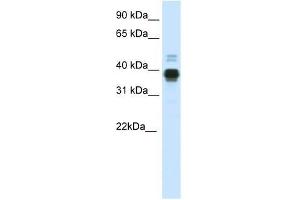 HOXA11 antibody used at 0. (Homeobox A11 antibody  (C-Term))