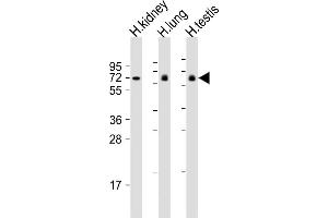 All lanes : Anti-LRRC1 Antibody (Center) at 1:2000 dilution Lane 1: human kidney lysate Lane 2: human lung lysate Lane 3: human testis lysate Lysates/proteins at 20 μg per lane. (LRRC1 antibody  (AA 298-330))
