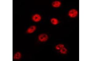 ABIN6275222 staining HepG2 by IF/ICC. (MED8 antibody  (C-Term))