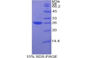 SDS-PAGE analysis of Rat Cardiotrophin 1 Protein. (Cardiotrophin 1 Protein (CTF1))