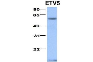 Host:  Rabbit  Target Name:  ETV5  Sample Type:  Human Fetal Heart  Antibody Dilution:  1. (ETV5 antibody  (N-Term))