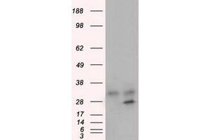 Image no. 1 for anti-Glycine N-Methyltransferase (GNMT) antibody (ABIN1498486) (GNMT antibody)