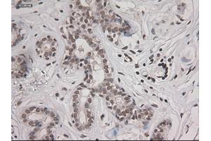 Immunohistochemical staining of paraffin-embedded breast using anti-STAT3 (ABIN2452542) mouse monoclonal antibody. (STAT3 antibody  (AA 154-175))