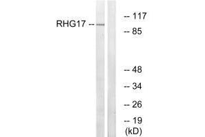 Western blot analysis of extracts from LOVO cells, using RHG17 antibody. (ARHGAP17 antibody)