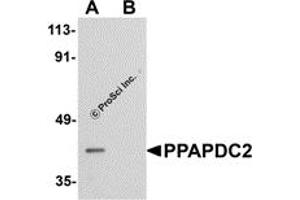 Western Blotting (WB) image for anti-Phosphatidic Acid Phosphatase Type 2 Domain Containing 2 (PPAPDC2) (C-Term) antibody (ABIN1030597) (PPAPDC2 antibody  (C-Term))