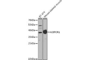 Western blot analysis of extracts of various cell lines, using  antibody (ABIN3022036, ABIN3022037, ABIN3022038 and ABIN6218580) at 1:1000 dilution. (Adiponectin Receptor 1 antibody  (AA 1-136))