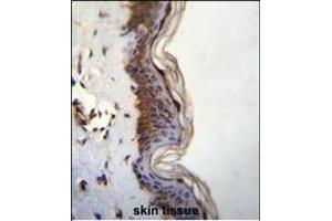 anti-Forkhead-Associated (FHA) Phosphopeptide Binding Domain 1 (FHAD1) (AA 1145-1173), (C-Term) antibody